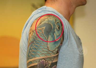 best tattoo removal cream reviews best tattoo removal cream reviews